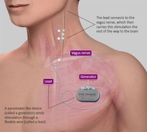 how-it-works-basic-page-image_0